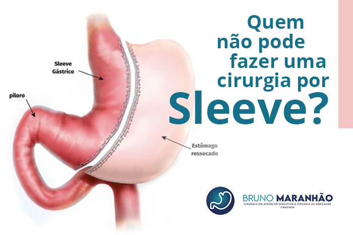 Sleeve Gástrico: O que é e para quem é indicado