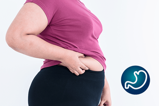 Relação entre Cirurgia bariátrica e Menstruação